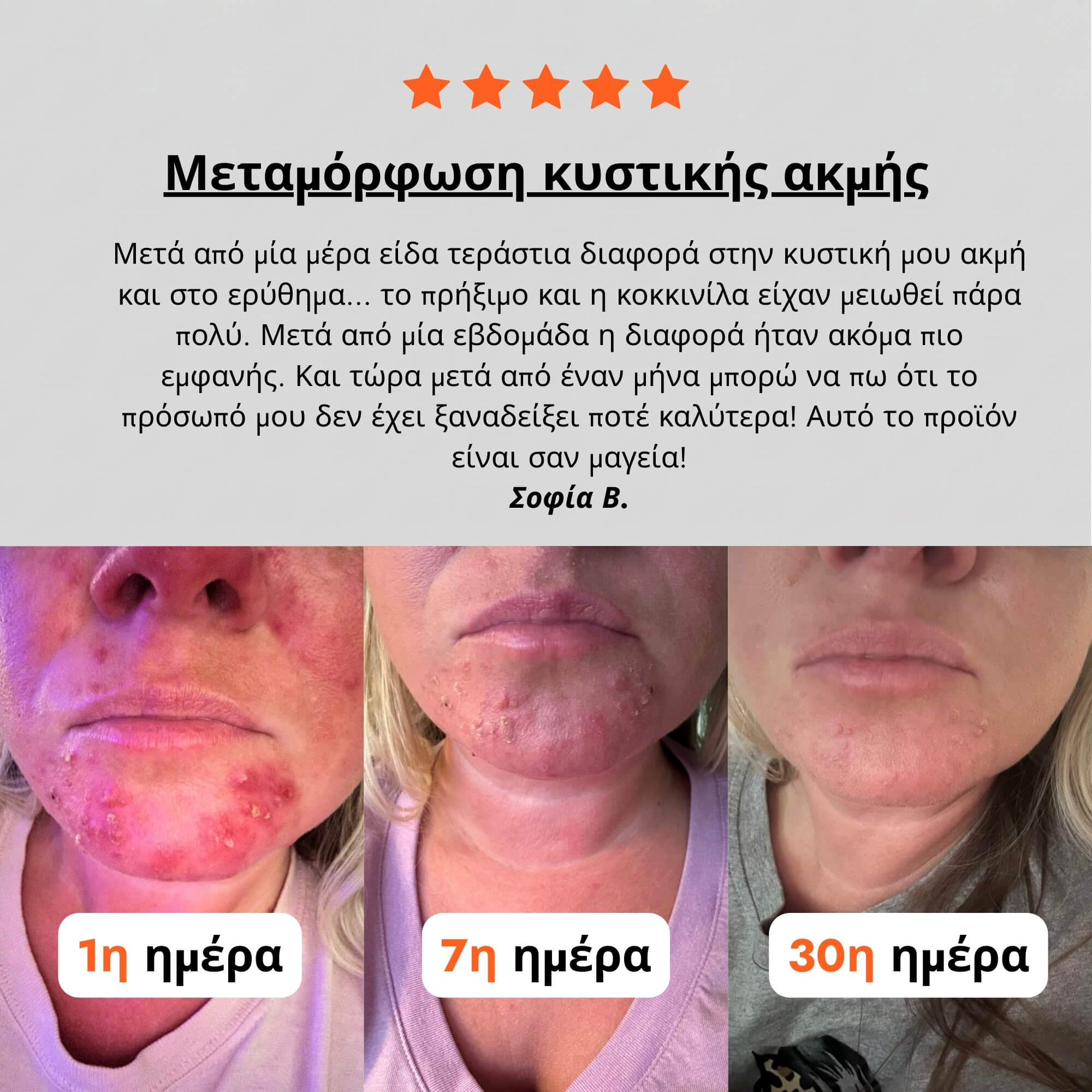 Κρέμα για Ακμή & Ερυθρότητα